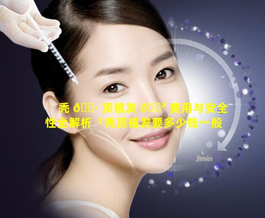 秃 🌷 顶植发 🌲 费用与安全性全解析「秃顶植发要多少钱一般」